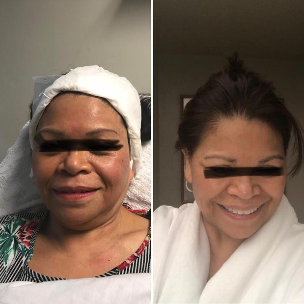 Images RAREV Med Spa