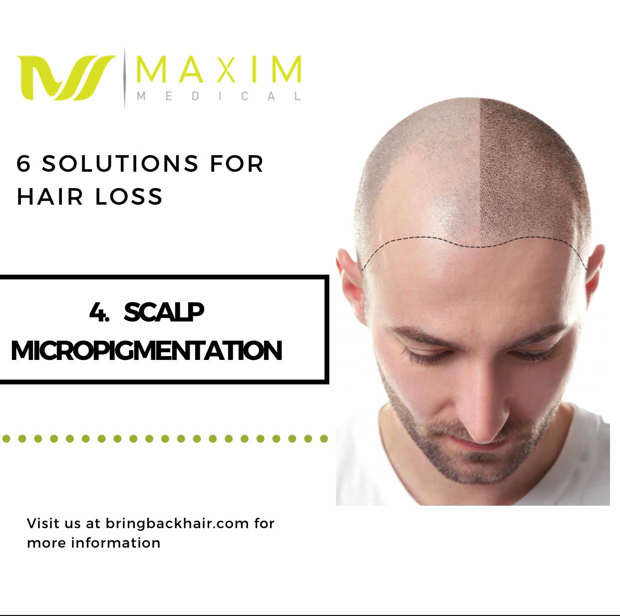 6 Solutions For Hair Loss

4. Scalp Micropigmentation
Scalp Micropigmentation (SMP) is another popular solution for hair loss. It is a non-invasive treatment that creates the appearance of tiny hair follicles, restoring the appearance of hair on a shaved scalp by creating the illusion of a thicker head of hair. The goal of SMP isn’t to create hairlike lines that are perfectly lined like microblading eyebrows, but instead to use tiny, layered dots in different hues of black to replicate the look of a shadow on your scalp. This style, referred to as pointillism, is done to create natural-looking depth and definition. It is also a great option when all you want is to add density to your hair.

Full article on our website: