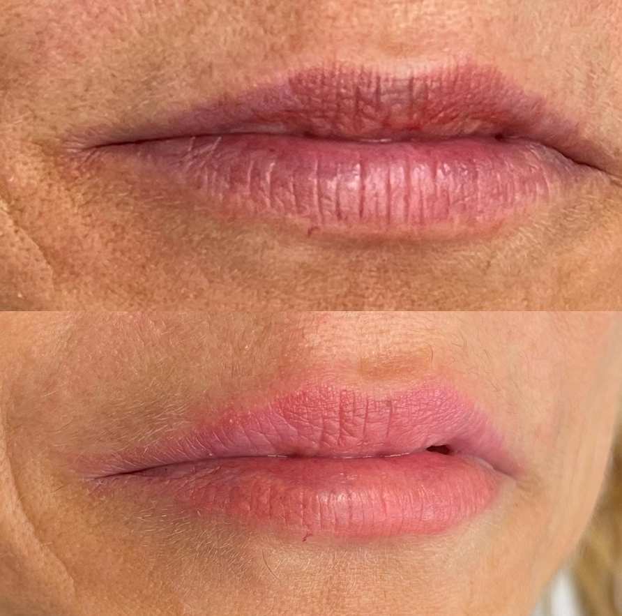 Images Clinique d'Esthétique Leila - Hydrafacial, Microblading, Épilation Laser Sainte-Foy