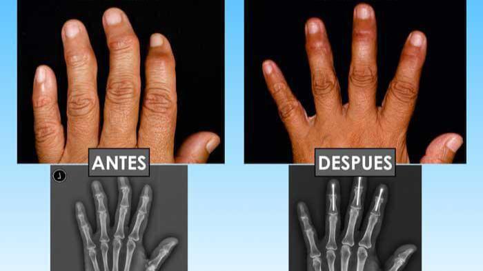 Baja Hand Clinic Dr. José Luis Aguilar Tijuana