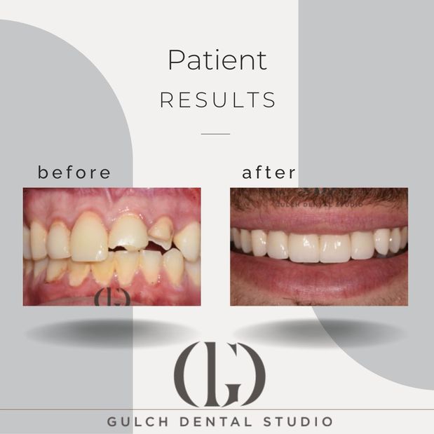Images Gulch Dental Studio