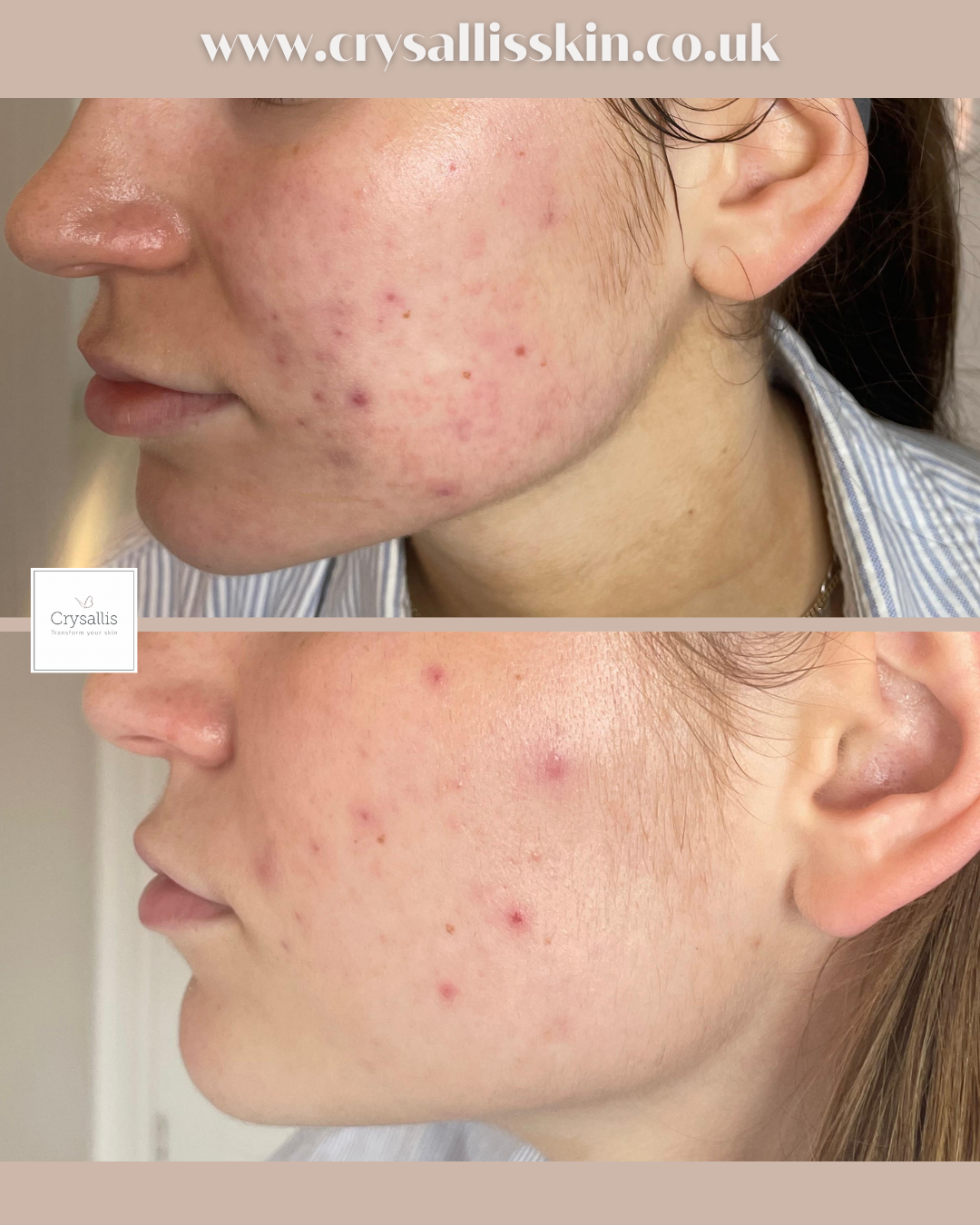 Images Crysallis Skin Clinic