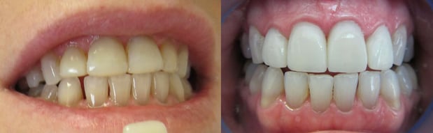 Images Premier Dental of South Orange County