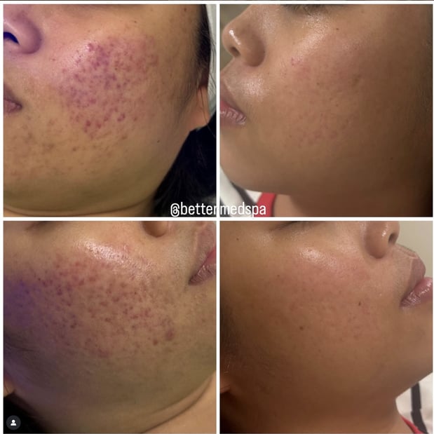 Images Better Med Spa & Wellness