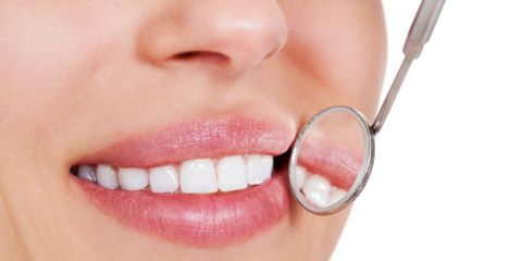 Ask a Dentist: Is It Safe to Whiten Teeth at Home? Mark Stephens DMD Richmond (859)626-0069