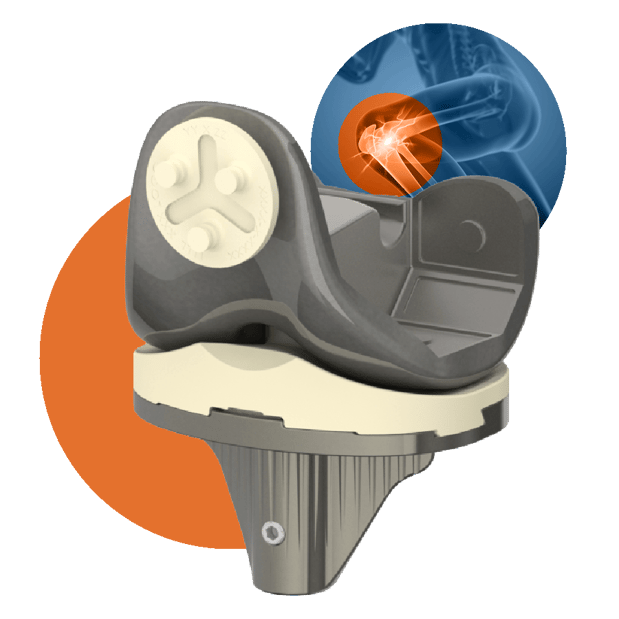 Images Optimotion Implants