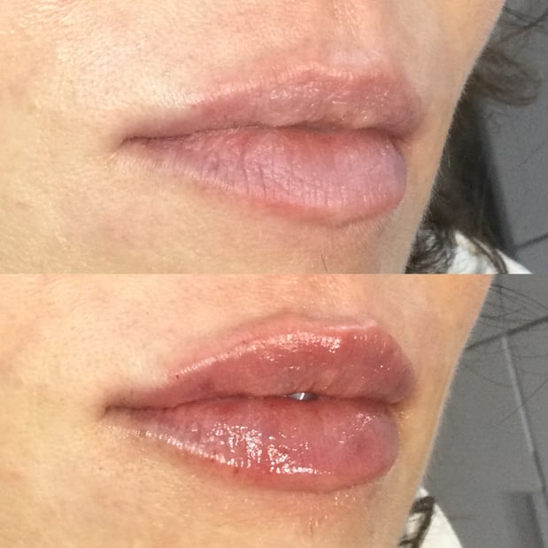 Images BCRN Aesthetics MedSpa