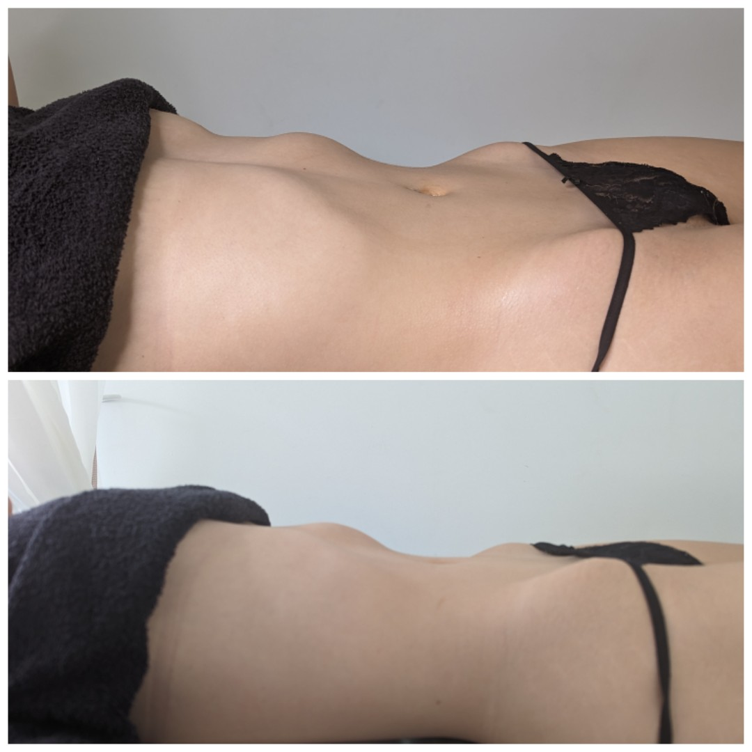 Images Strictly Curves - Non Surgical Face & Body Treatments