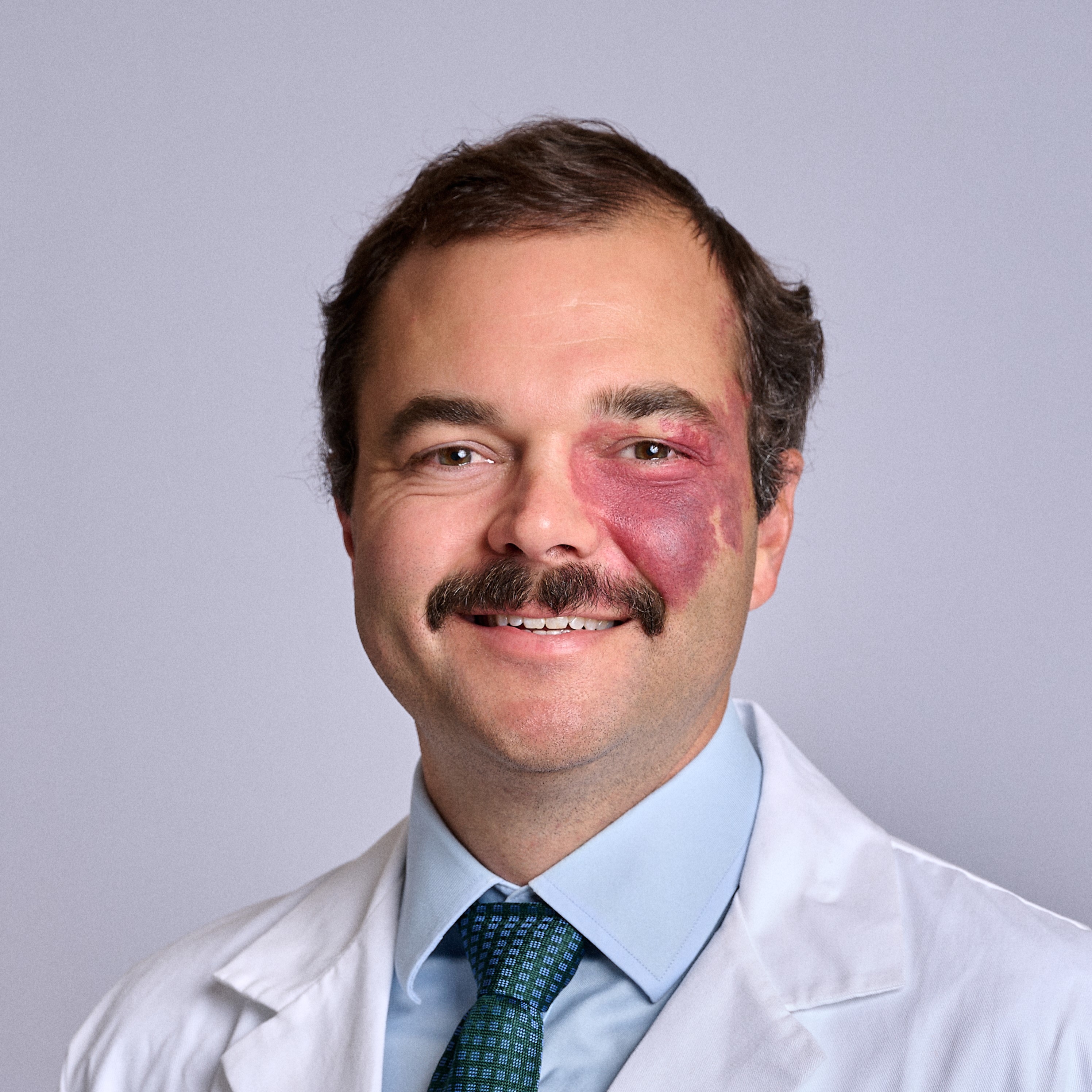 William Sawyer, MD - New Orleans, LA - Transplant Surgery, Transplant Surgeon