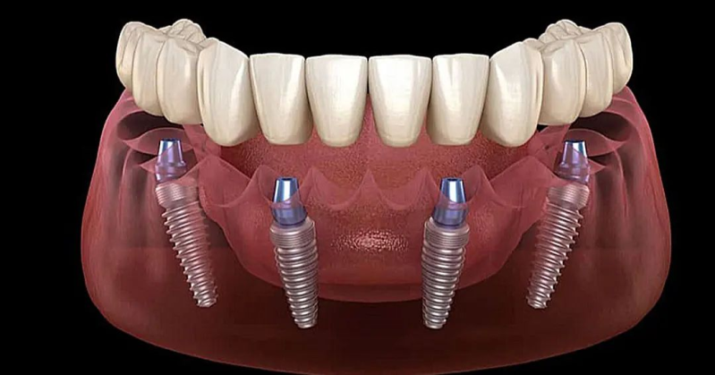 Images Cantarella Dr.ssa Vincenzina - Studio Dentistico