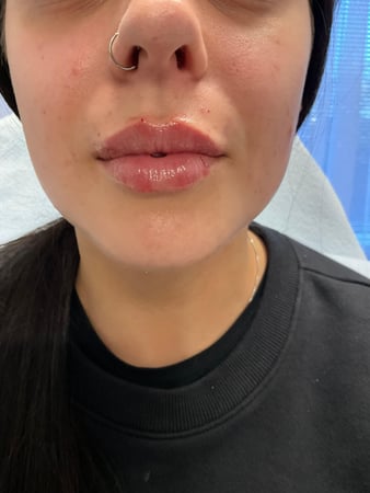 Images ProSculpt Med Spa