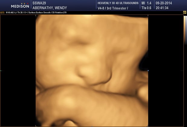 Images Heavenly 3D 4D Ultrasounds-Upland