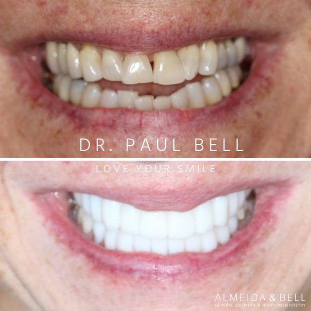 Images Almeida & Bell Dental Lone Tree - General, Cosmetic, and Implant Dentistry