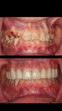 Images Sunbrite Dental