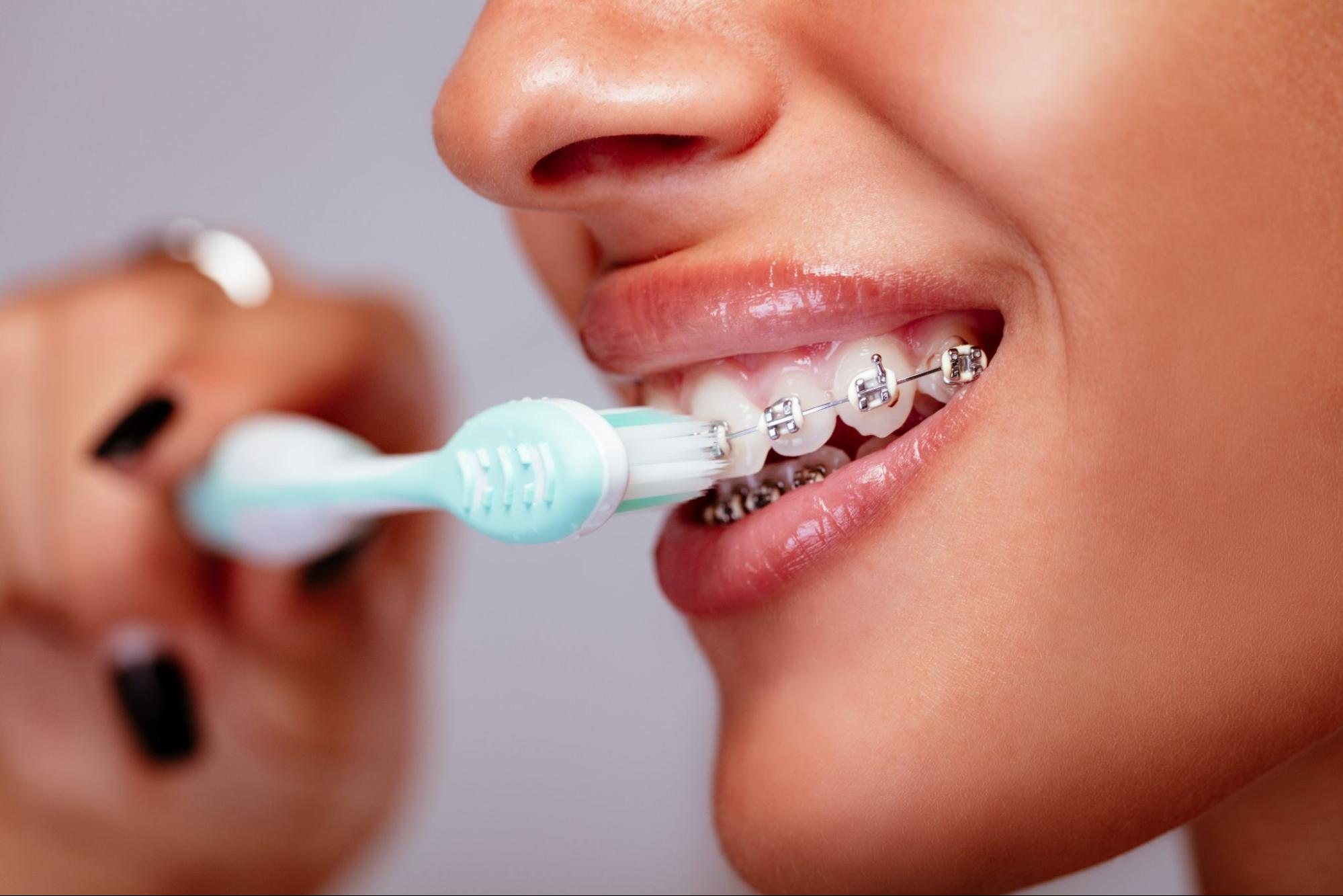 Sturbridge Orthodontics Image