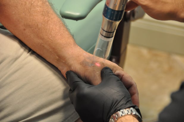 Images ReversaTatt Tattoo Removal