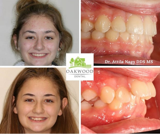 Images Oakwood Dental Orthodontics and General Dentistry