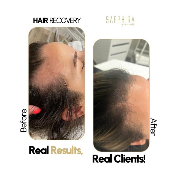 Images Sapphira Prive Winter Garden MedSPA