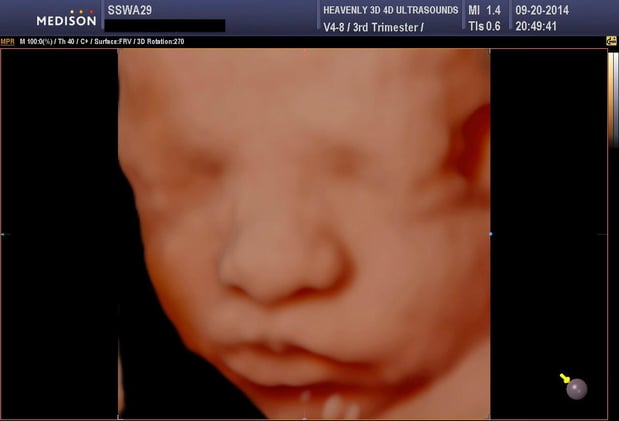 Images Heavenly 3D 4D Ultrasounds-Upland