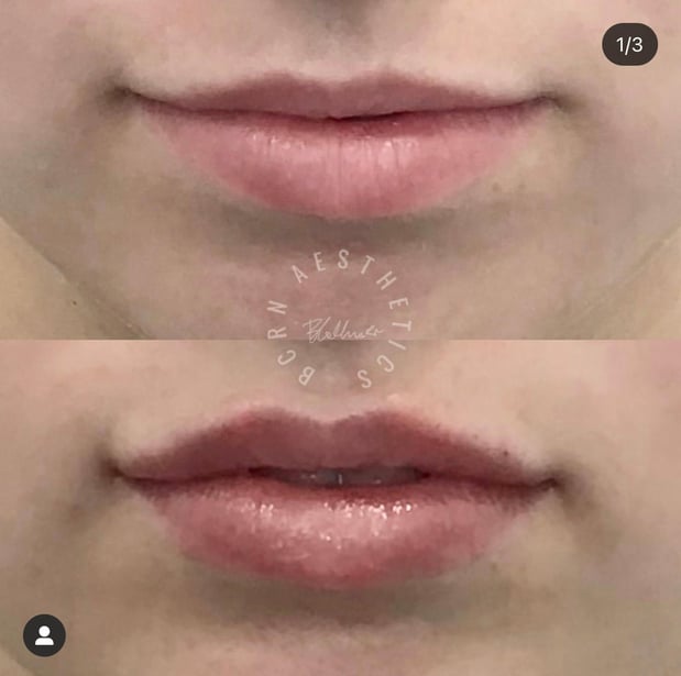 Images BCRN Aesthetics MedSpa