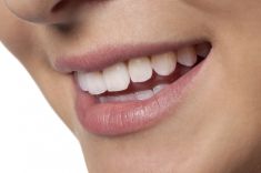 Check-up / General Dental Exam Ballyfermot Dental Practice Dublin (01) 626 5776