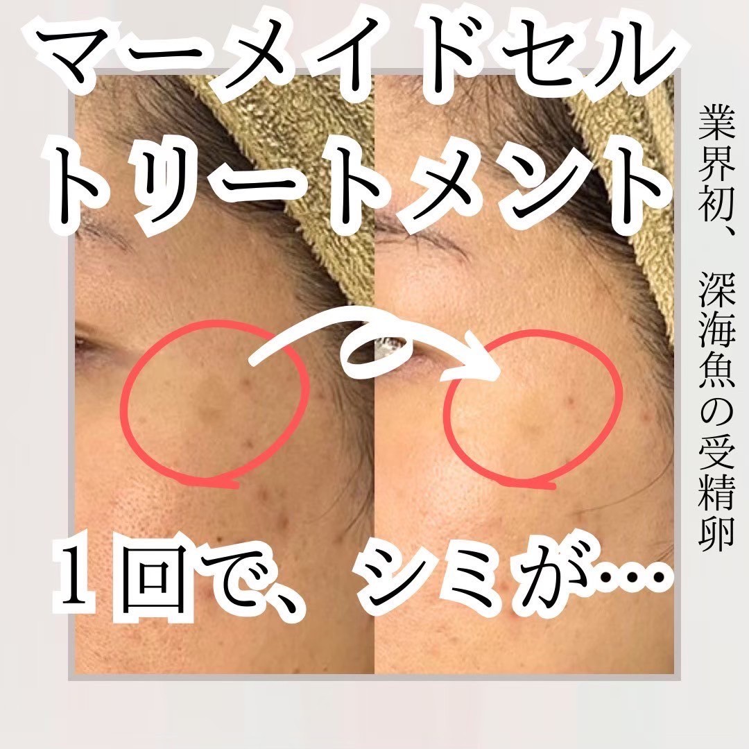 Images アディス リティフル