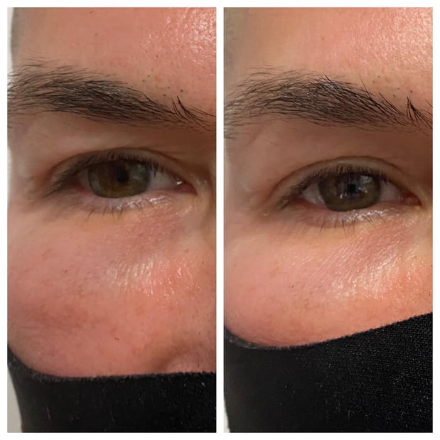 Images Renew Body Contouring & MedSpa