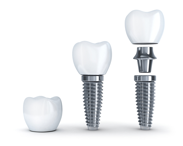 Images Castor Dental Care