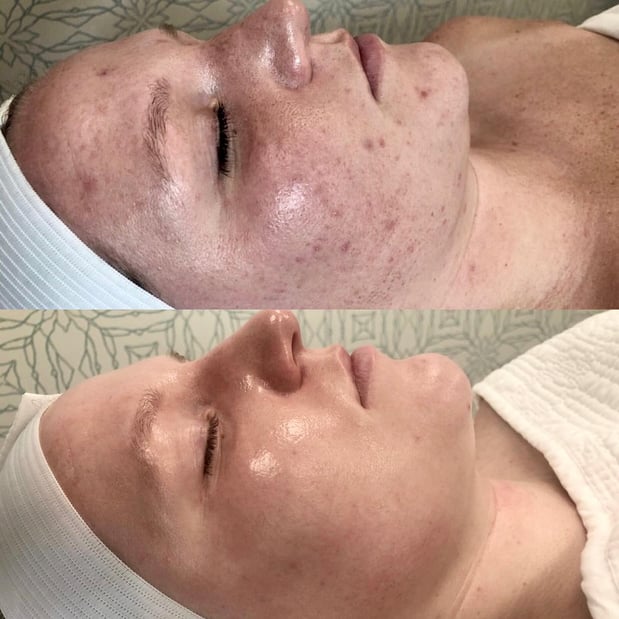 Images Glow Medical Spa