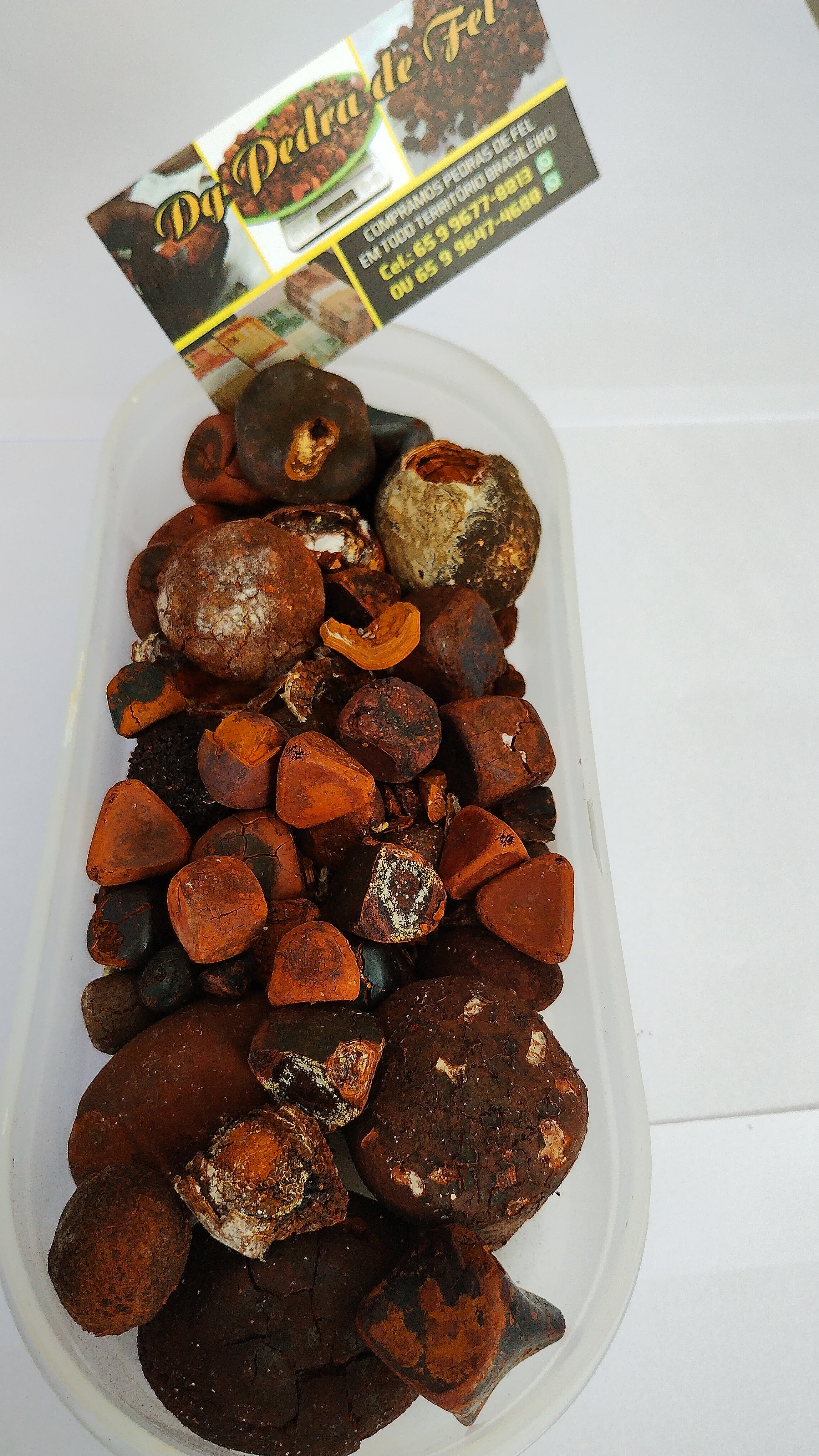 Images Dg pedras de fel bovinos