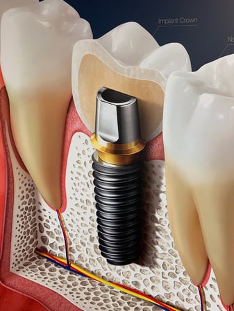 Images Dental Excellence of Pennsauken