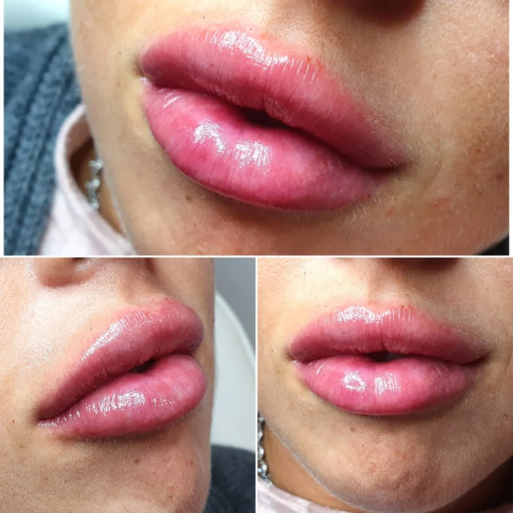 Images Lincoln Aesthetic