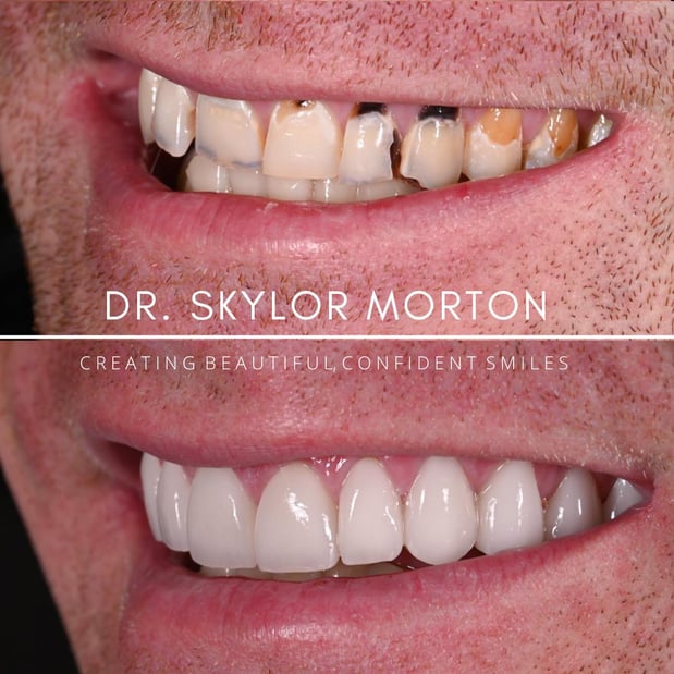 Images Nashville Wisdom Teeth and Implant Solutions