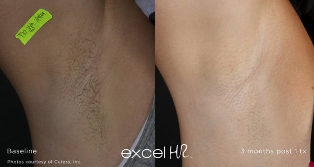 Images Celtic Spa & Laser Services