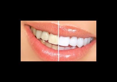 Images Studio Dentistico Dr. Giovanni Golinelli