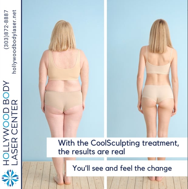 Images Hollywood Body & Face Denver/Metro