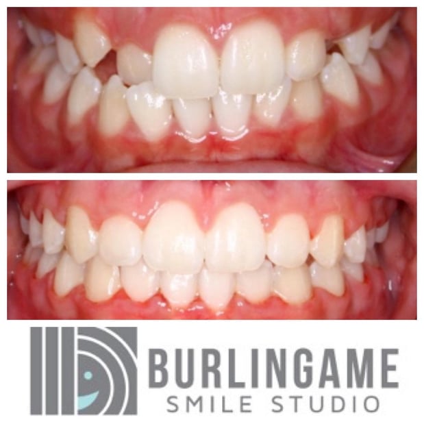 Images Burlingame Smile Studio Orthodontist April Lee DDS MS