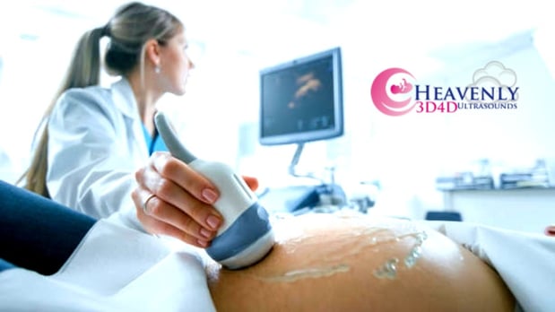 Images Heavenly 3D 4D Ultrasounds