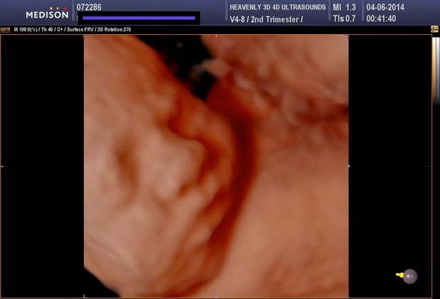 Images Heavenly 3D 4D Ultrasounds-Upland