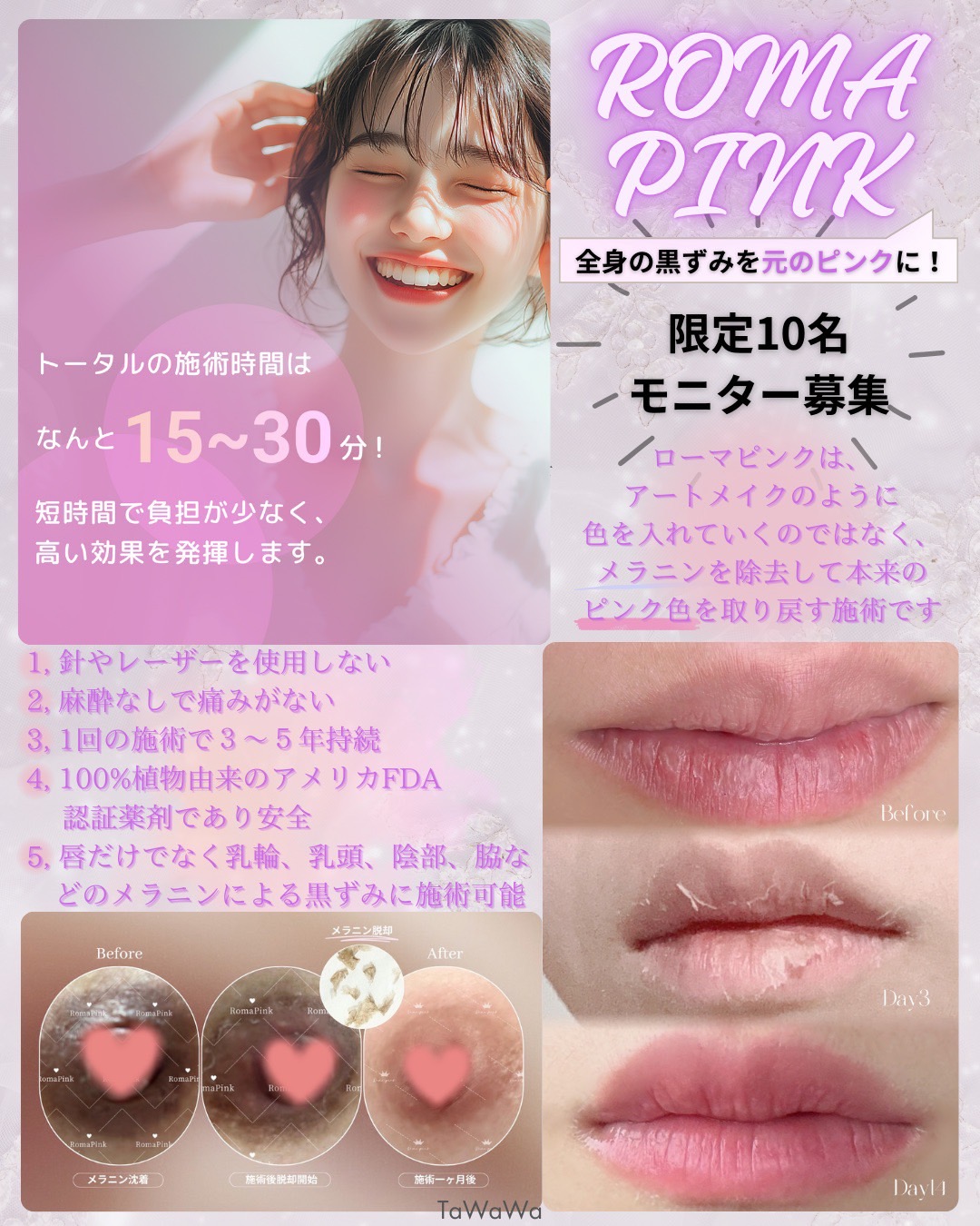 Images バストアップ専門サロン TaWaWa