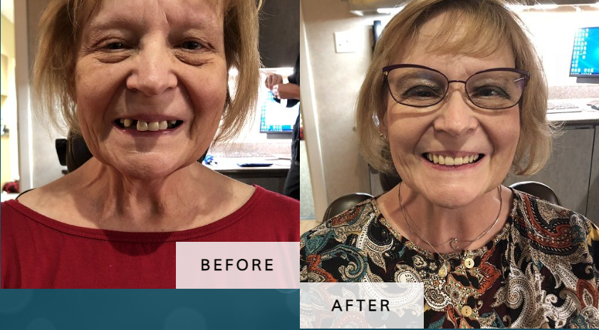 Before & After of Andrew R. Glenn, DDS, MD | Lincoln, NE