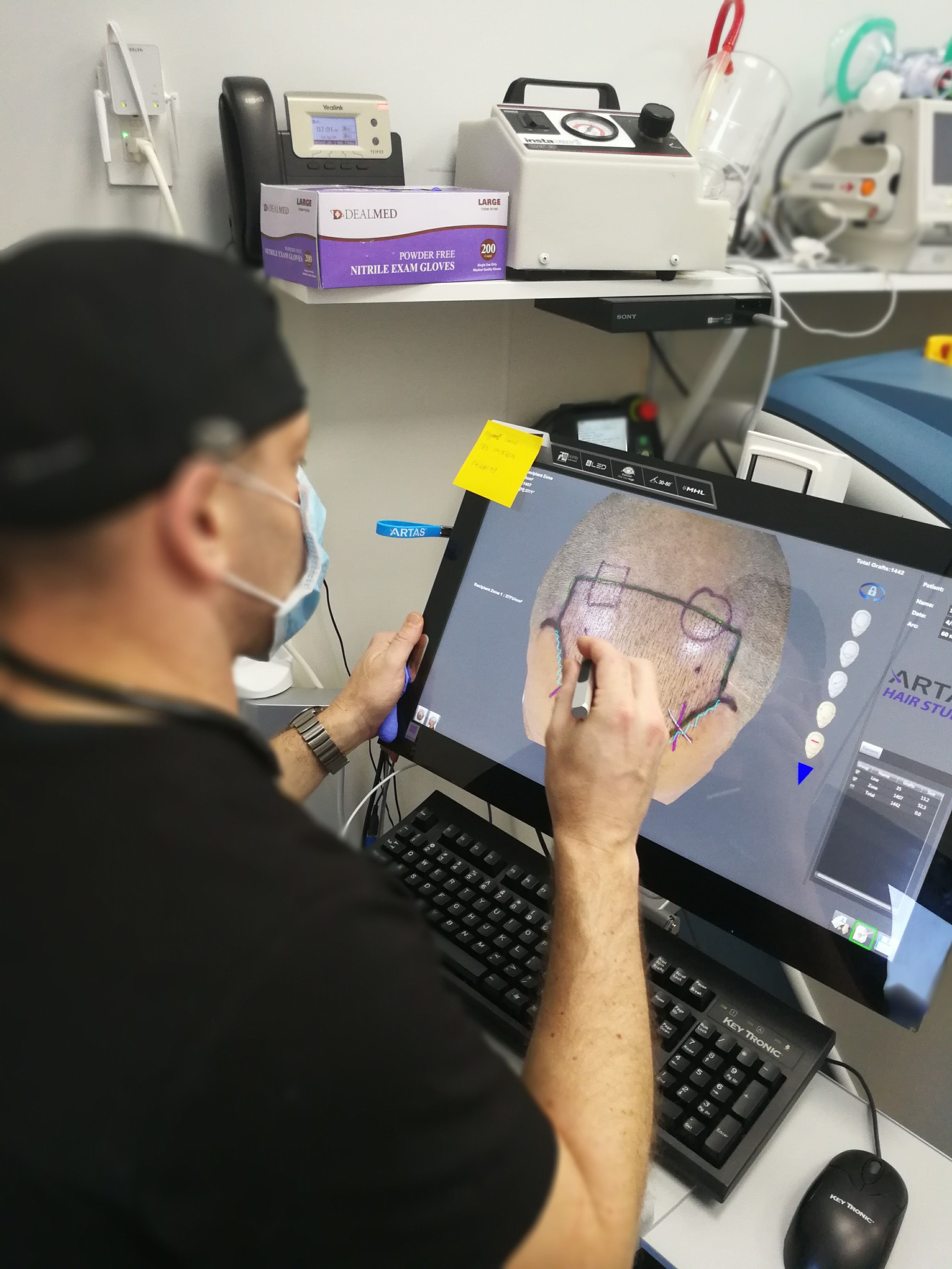 Dr. Max creating a digital map with ARTAS robotic hair transplant system