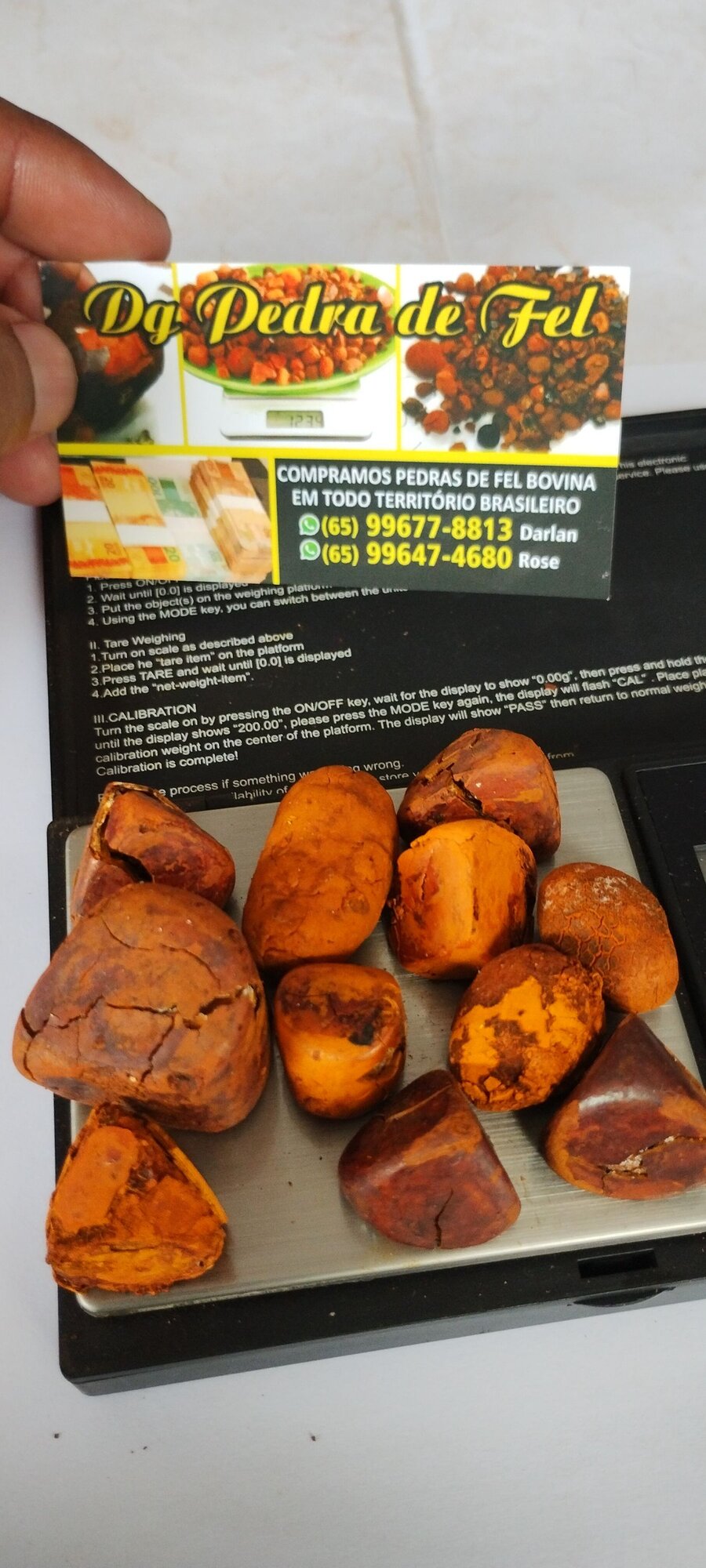 Images Dg pedras de fel bovinos