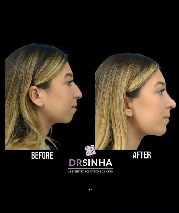 Images Pradeep K Sinha MD PhD FACS - Facial Aesthetic Surgery