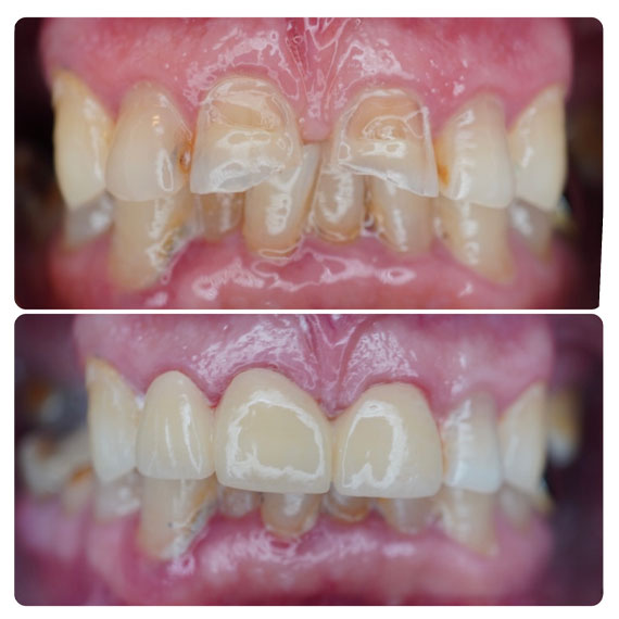Cortes Family Dentistry- dientes