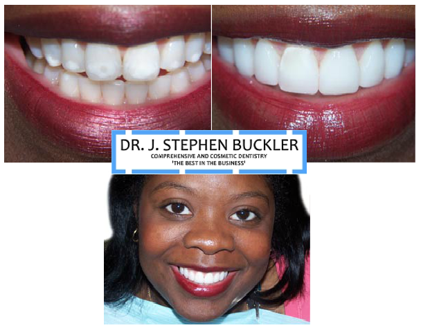 Express smile atlanta coupon code