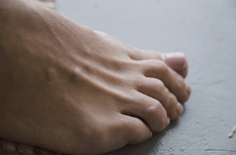 Foot discomfort that keeps returning often points to a structural issue rather than a temporary strain. Addressing alignment, support, and movement patterns can make a lasting difference. Westfield Foot and Ankle provides careful foot care evaluations with a podiatrist who looks at the full picture. Patients across Westfield, Carmel, Noblesville, Fishers, Northfield, Sheridan., schedule an appointment.
