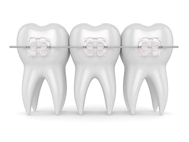 Bild 6 Fachzentrum Kieferorthopädie Hildesheim Prof. Dr. Dr. Christian Scherer in Hildesheim