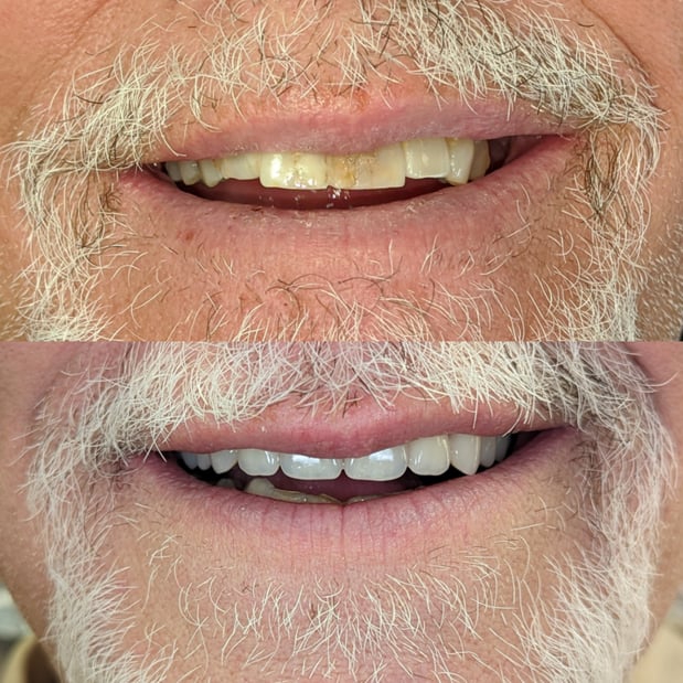 Images South Weber Dental