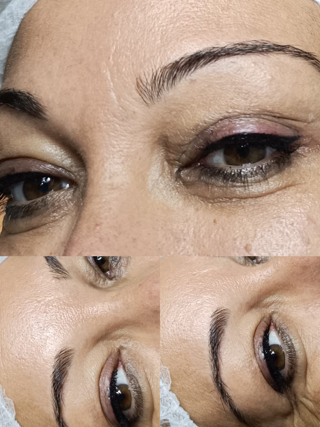 Images Liliana Estética